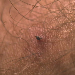Tick Remover Tool (Compact Card) - Life Systems