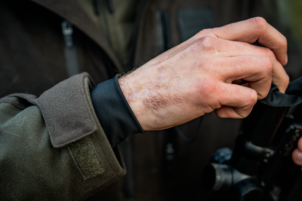 Chaser BGH Smock - Pine green